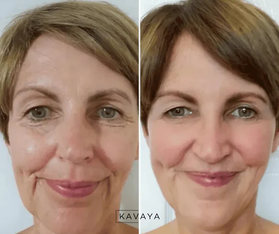 Brosse facial drainage lymphatique - Kavaya™