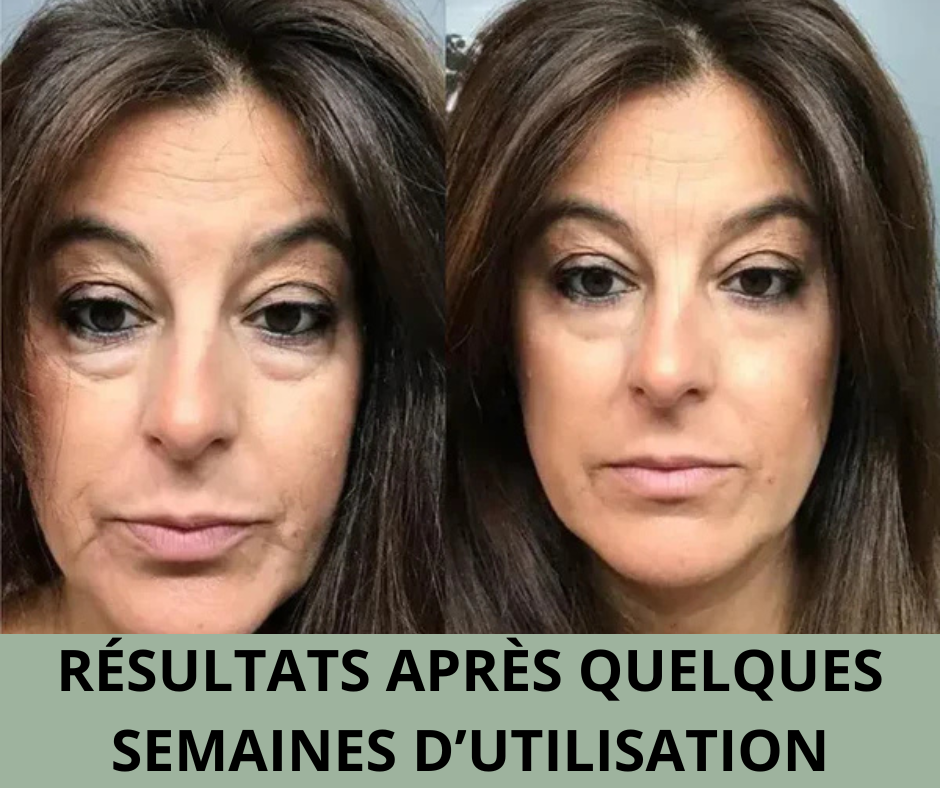 Brosse facial drainage lymphatique - Kavaya™